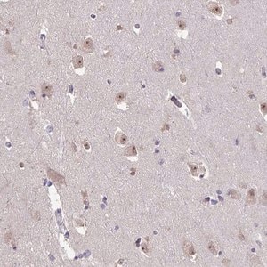 Merck Anti-SENP3 antibody produced in rabbit