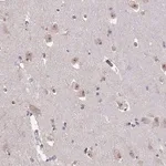 Merck Anti-SENP3 antibody produced in rabbit