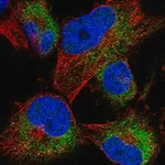 Merck Anti-ACBD7 antibody produced in rabbit