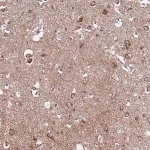 Merck Anti-EVA1B antibody produced in rabbit