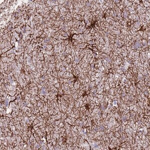 Merck Anti-TAS2R38 antibody produced in rabbit