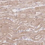 Merck Anti-MCRIP2 antibody produced in rabbit