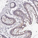 Merck Anti-ARL4D antibody produced in rabbit