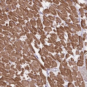 Merck Anti-KIAA1161 antibody produced in rabbit