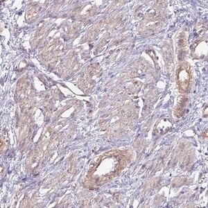 Merck Anti-GTSE1 antibody produced in rabbit