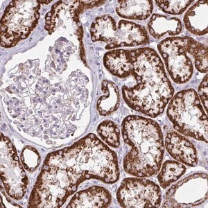 Merck Anti-TVP23A antibody produced in rabbit