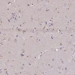 Merck Anti-ZNF34 antibody produced in rabbit