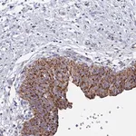 Merck Anti-ANKRD34C antibody produced in rabbit