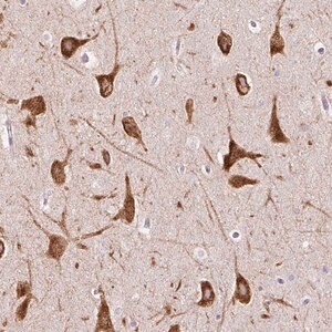 Merck Anti-FMC1 antibody produced in rabbit