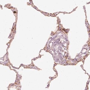 Merck Anti-DAPP1 antibody produced in rabbit