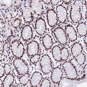 Merck Anti-SNRPA1 antibody produced in rabbit