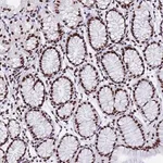 Merck Anti-SNRPA1 antibody produced in rabbit