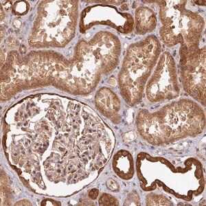 Merck Anti-ZNF322 antibody produced in rabbit