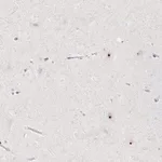 Merck Anti-CHD2 antibody produced in rabbit