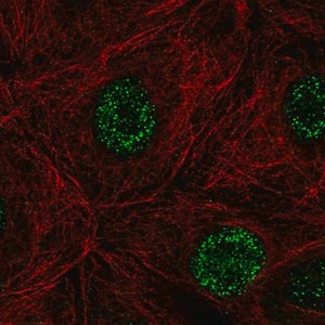 Merck Anti-DCAKD antibody produced in rabbit