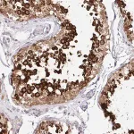 Merck Anti-HPS1 antibody produced in rabbit
