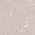 Merck Anti-OR51D1 antibody produced in rabbit