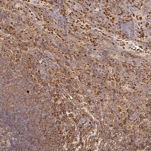 Merck Anti-FGF21 antibody produced in rabbit