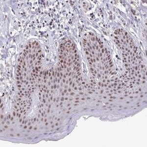 Merck Anti-ZNF691 antibody produced in rabbit