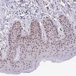 Merck Anti-ZNF691 antibody produced in rabbit