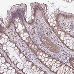Merck Anti-NACC2 antibody produced in rabbit