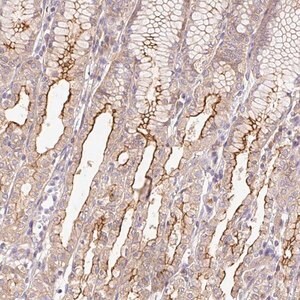 Merck Anti-DESI1 antibody produced in rabbit