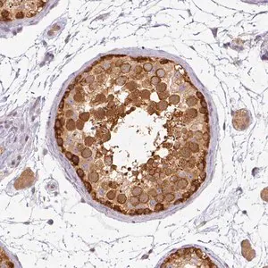 Merck Anti-AGPAT4 antibody produced in rabbit