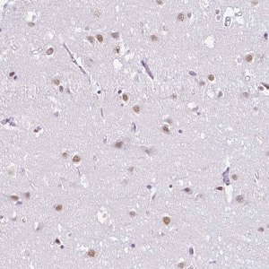 Merck Anti-DCAF17 antibody produced in rabbit