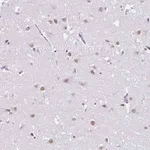 Merck Anti-DCAF17 antibody produced in rabbit