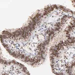 Merck Anti-ZFP92 antibody produced in rabbit