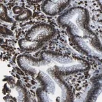 Merck Anti-NCBP3 antibody produced in rabbit