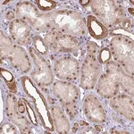 Merck Anti-GTF2H3 antibody produced in rabbit