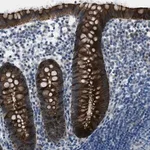 Merck Anti-KLHL8 antibody produced in rabbit