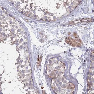 Merck Anti-TMBIM6 antibody produced in rabbit