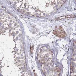 Merck Anti-TMBIM6 antibody produced in rabbit