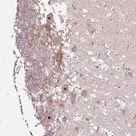 Merck Anti-NOM1 antibody produced in rabbit