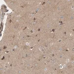 Merck Anti-PDE1C antibody produced in rabbit