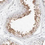 Merck Anti-RTN4 antibody produced in rabbit