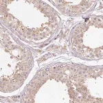 Merck Anti-RB1CC1 antibody produced in rabbit
