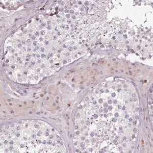 Merck Anti-ZNF583 antibody produced in rabbit