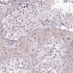 Merck Anti-ZNF583 antibody produced in rabbit