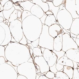 Merck Anti-ADIRF antibody produced in rabbit