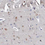 Merck Anti-GLB1L3 antibody produced in rabbit