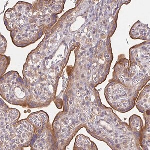 Merck Anti-EEF1AKMT1 antibody produced in rabbit