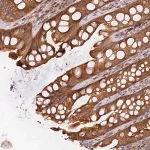 Merck Anti-HGF antibody produced in rabbit