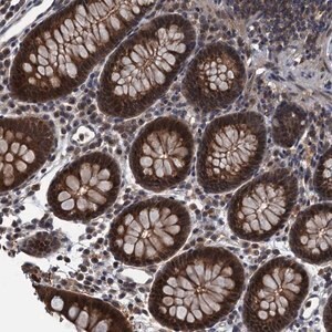 Merck Anti-RNF165 antibody produced in rabbit