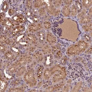 Merck Anti-ATP10A antibody produced in rabbit