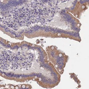 Merck Anti-CYP2U1 antibody produced in rabbit