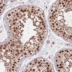 Merck Anti-RIF1 antibody produced in rabbit
