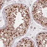 Merck Anti-RIF1 antibody produced in rabbit